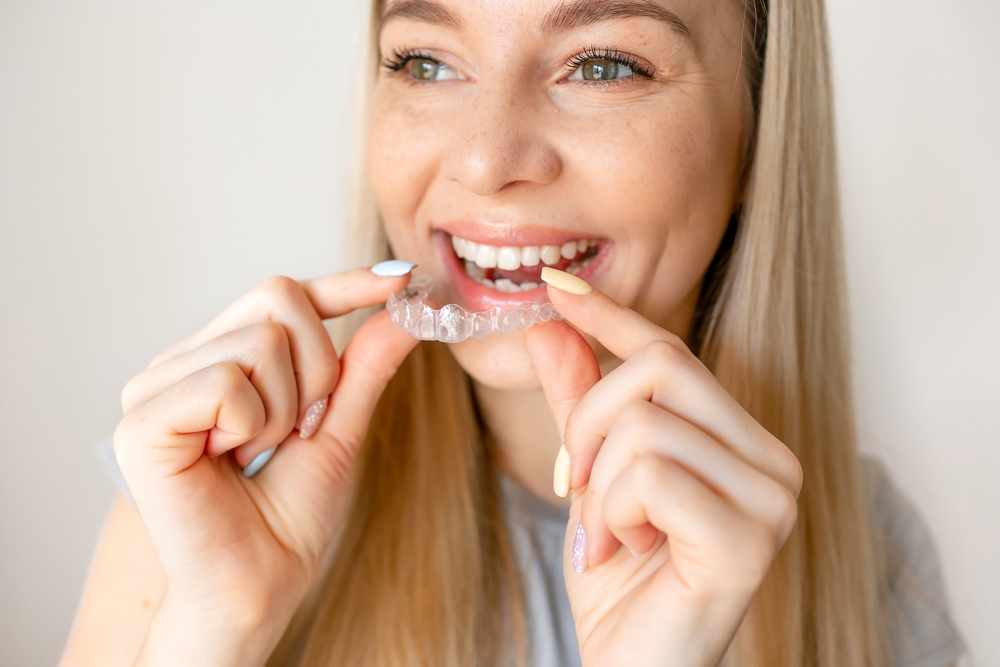 Clear Aligners in Las Vegas Elevate Dental Dentist in Las Vegas